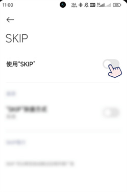 SKIP